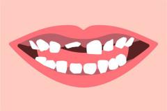 梦见自己用手拔掉牙齿