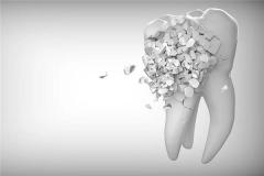 梦见吐出来好多碎牙齿