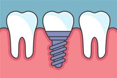 女人梦见掉了半颗牙