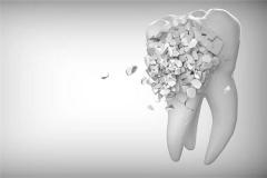 女人梦见牙齿碎了掉渣渣