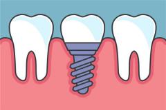 梦见满口牙掉吐在手上
