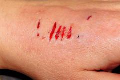 女人梦见左手流血